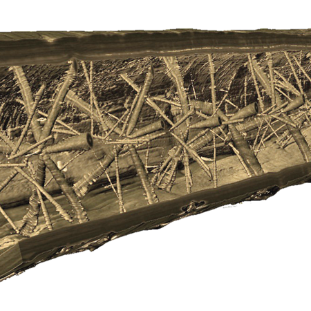 Computed Tomography (CT)